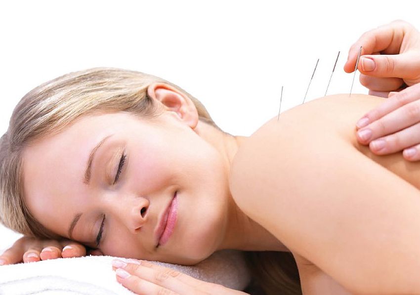 Иглоукалывание или иглорефлексотерапия эффективные методы лечения и их преимущества